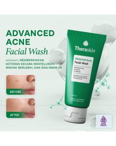 Theraskin Advanced Acne Facial Wash 100ml