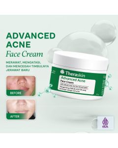 Theraskin Advanced Acne Face Cream