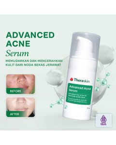 Theraskin Advanced Acne Serum 15g